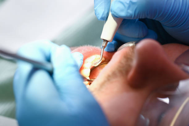 Best Urgent Dental Care for Toothaches in Ester, AK